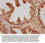 HYI Antibody