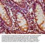 HYI Antibody