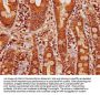 CPTP Antibody