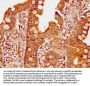 PIK3R6 Antibody