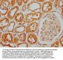 KANK2 Antibody