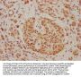 PLA2G4F Antibody
