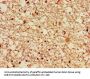 LRRK2 Antibody
