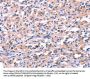 FEM1B Antibody
