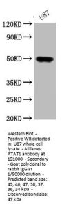 ATAT1 Antibody