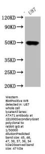 ATAT1 Antibody