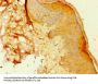 Rabbit anti-human Annexin A8-like protein 2 polyclonal Antibody(ANXA8L2)
