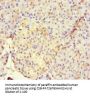 RUNX1T1 Antibody