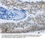 MMP21 Antibody