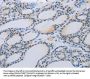 MMP21 Antibody