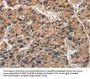 ABI3BP Antibody