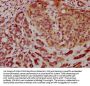 BROX Antibody