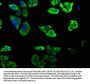 DAB2IP Antibody