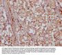 RARS2 Antibody