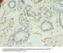 LYPLAL1 Antibody