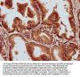 MCTP2 Antibody