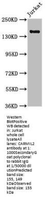 CARMIL2 Antibody