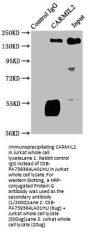 CARMIL2 Antibody