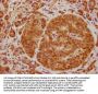 CAPRIN2 Antibody