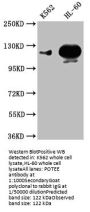 POTEE Antibody