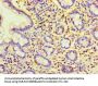KYAT3 Antibody