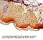 ATG14 Antibody