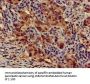 ATG14 Antibody