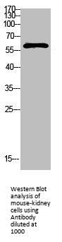 FBXO7 Antibody
