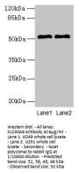 SLC30A6 Antibody