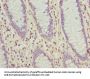 SLC30A6 Antibody