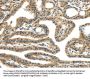 TMPRSS11E Antibody
