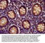 EDC4 Antibody