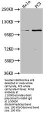 PKN3 Antibody