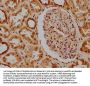 PKN3 Antibody