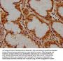 PKN3 Antibody