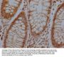 RHBDF2 Antibody