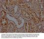 RHBDF2 Antibody