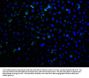 RHBDF2 Antibody