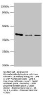 RRM2B Antibody