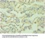 RRM2B Antibody