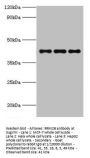 RRM2B Antibody