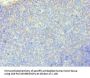 RRM2B Antibody