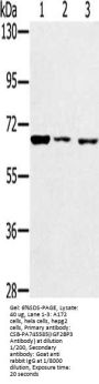 IGF2BP3 Antibody