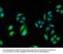 TCTN3 Antibody