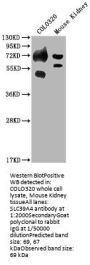 SLC39A4 Antibody