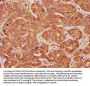 CRTC3 Antibody