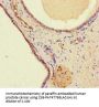 WDFY4 Antibody