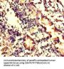 WDFY4 Antibody