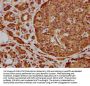 NEK10 Antibody