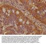 NEK10 Antibody